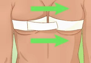 Breast cleavage duct tape: medical quality. South Africa, Pretoria, Villieria